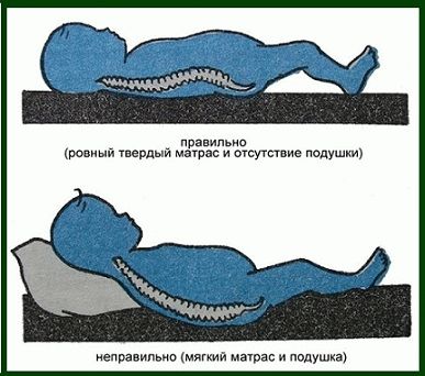 Неправильный и правильный матрасы 